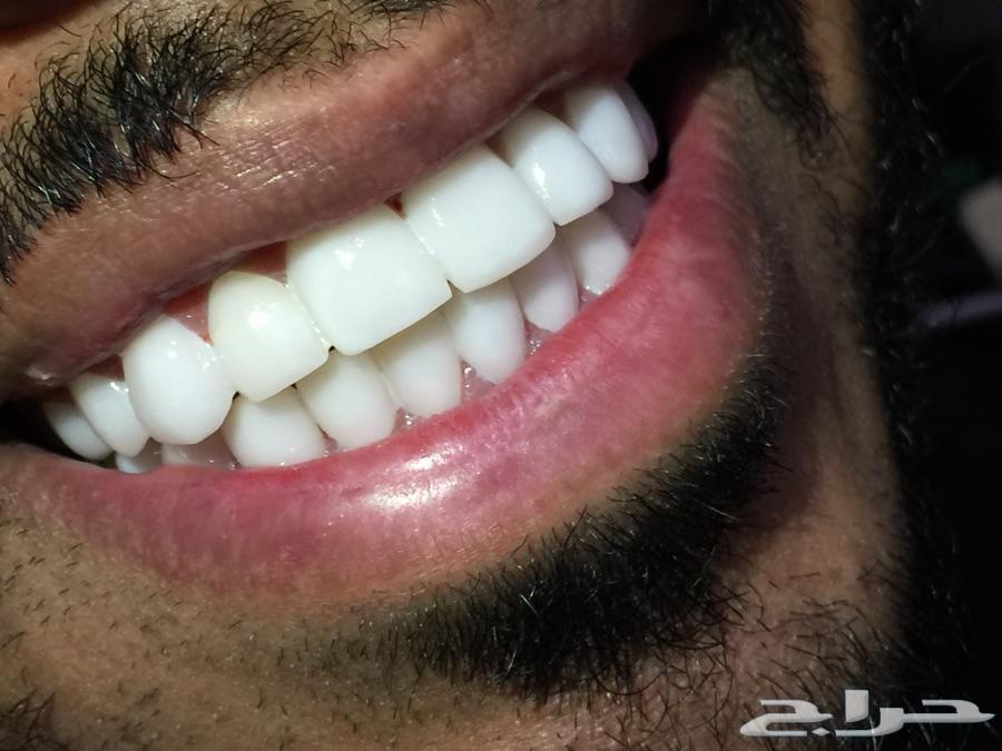 عروض ولا اقوى لحق واحجز موعدك