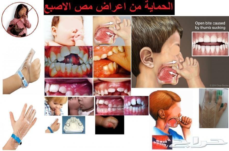 منتج امريكي فعال لمنع مص الاصبع للاطفال
