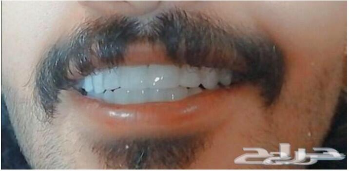 فينير اجمل اروع ابتسامة