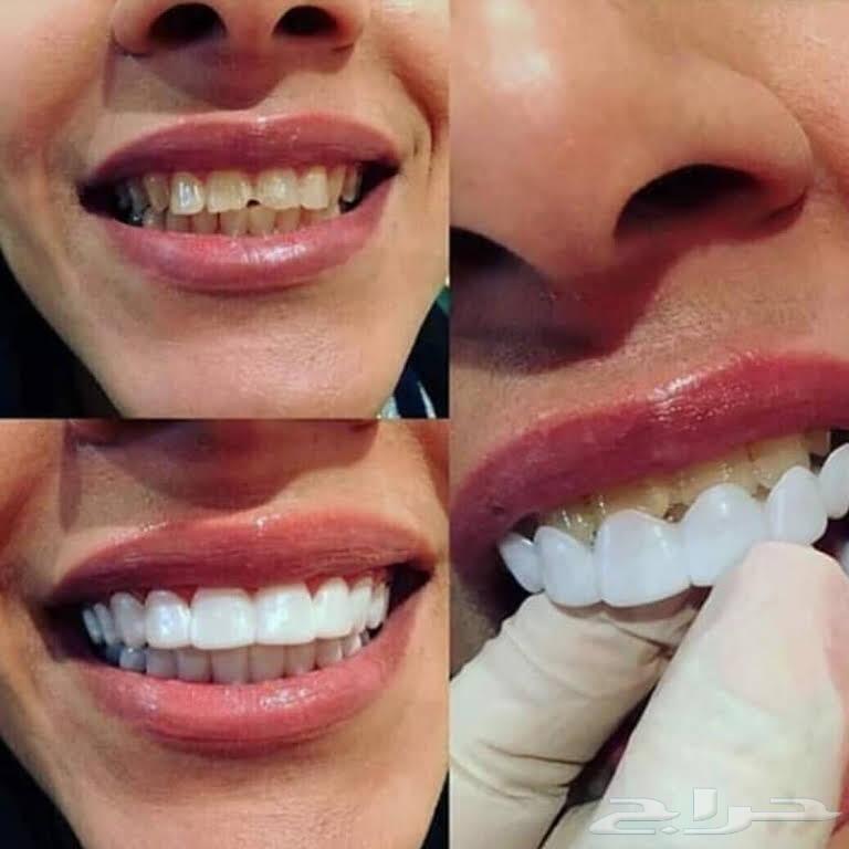 فينير اجمل اروع ابتسامة